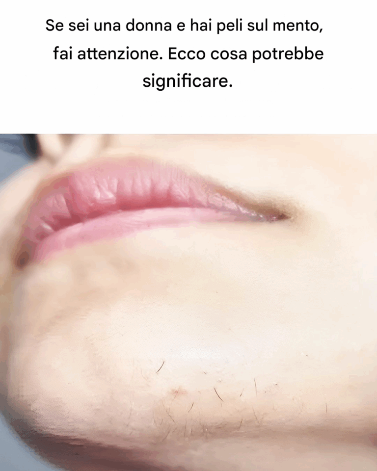 Peli sul Mento nelle Donne: Cosa Significano Davvero? Tutto quello che c'è da sapere