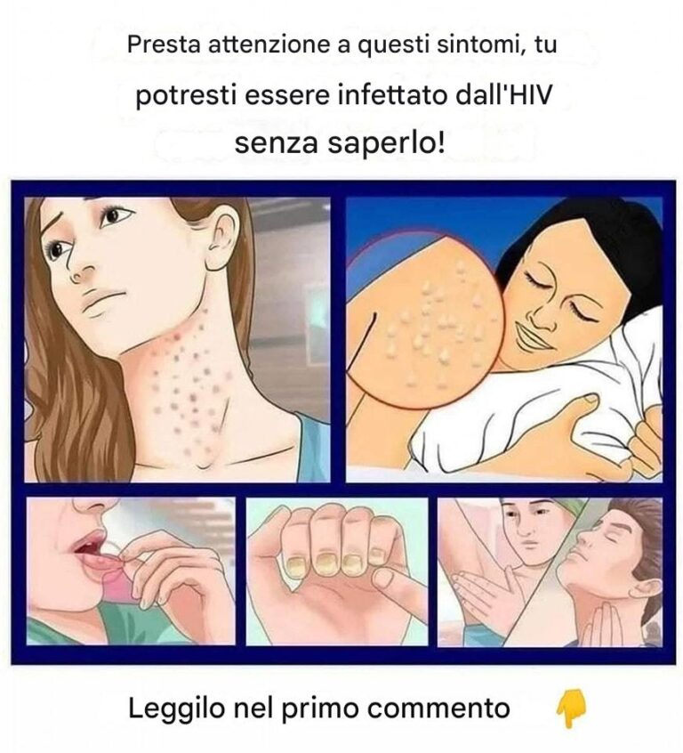 HIV: i primi sintomi da non ignorare.
