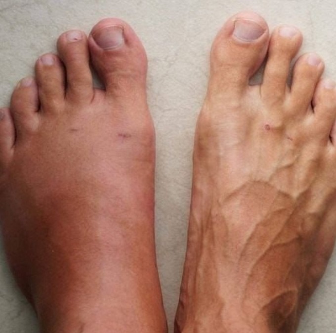 Un mese prima di un infarto, il tuo corpo ti avvertirà con questi 7 segnali.