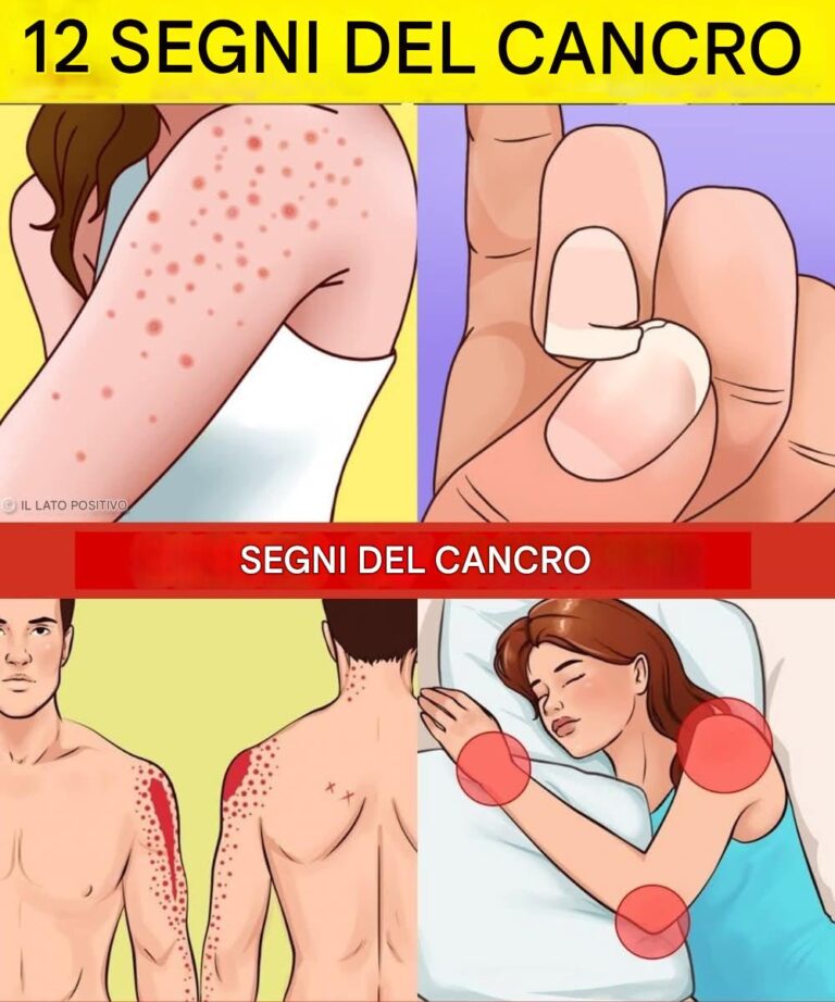 12 segnali premonitori che indicano che il tuo corpo sta sviluppando cellule cancerose