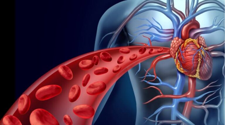 Malattie circolatorie