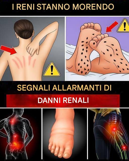 15 segnali letali di problemi renali che devi individuare in tempo