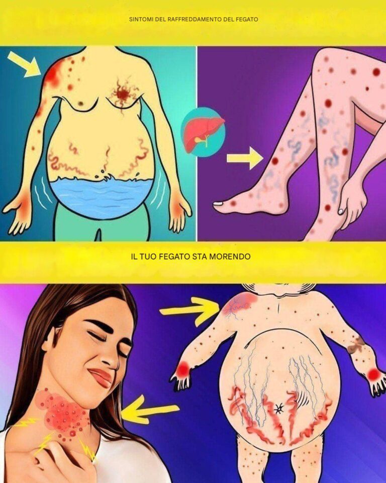 17 segnali che indicano che c'è qualcosa che non va nel tuo fegato