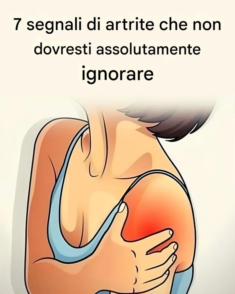 7 segnali di artrite che dovresti conoscere