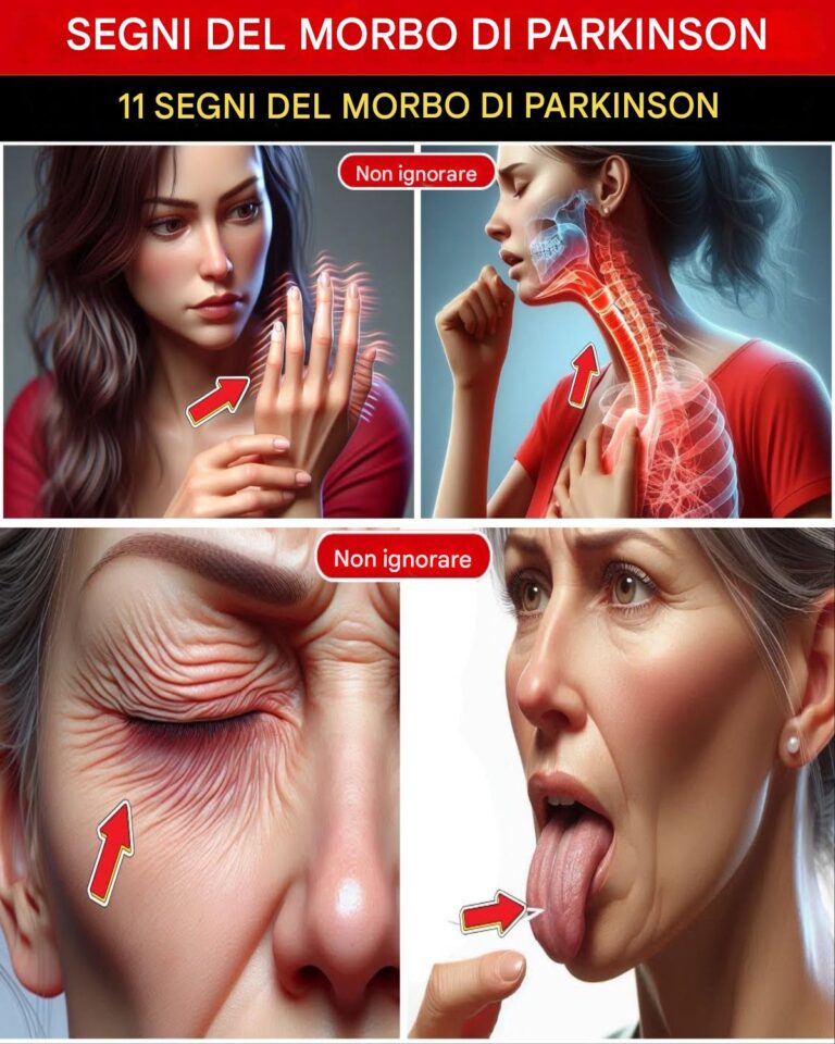 11 segnali d'allarme del Parkinson che la maggior parte delle persone ignora finché non è troppo tardi