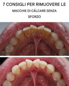 7 consigli geniali per rimuovere le macchie di calcare