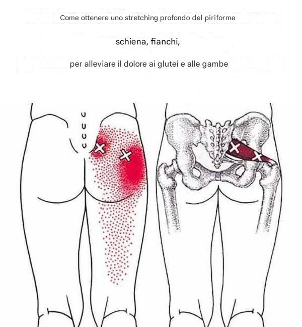 Come allungare profondamente il piriforme e alleviare il dolore alla schiena, ai fianchi, ai glutei e alle gambe