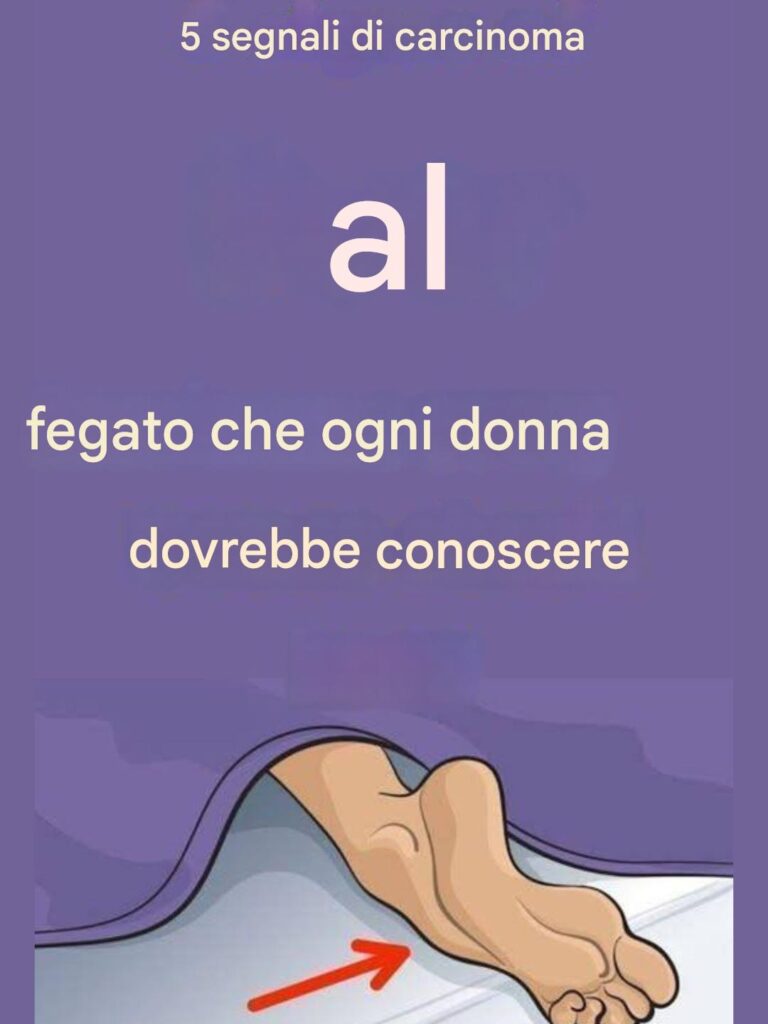 I segnali d'allarme del carcinoma epatico che ogni donna deve conoscere    Il fegato è l'eroe silenzioso del nostro corpo: filtra le tossine, elabora i nutrienti e aiuta il metabolismo.  Ma quando qualcosa va storto, come nel caso del carcinoma epatico , spesso sussurra i suoi segnali d'allarme anziché urlarli.  E poiché il carcinoma epatico in fase iniziale solitamente non presenta sintomi evidenti, molte donne non si rendono conto di avere un problema finché la malattia non è in fase avanzata.  Ecco perché la consapevolezza è importante.  Non è necessario vivere nella paura. Ma è necessario sapere a cosa fare attenzione.  Ecco 5 segnali chiave del carcinoma epatico che ogni donna dovrebbe riconoscere, così da poter intervenire tempestivamente, sottoporsi al test e proteggere la propria salute.     🚨 1. Perdita di peso inspiegabile    Perdere peso senza impegnarsi, soprattutto se si perdono 4,5 chili o più in poco tempo, non è una "vittoria". Potrebbe essere un campanello d'allarme.  Perché accade: i tumori al fegato alterano il normale metabolismo e l'appetito. Il carcinoma epatico può anche indurre l'organismo a bruciare calorie in modo anomalo. Quando preoccuparsi: se non hai modificato la tua dieta o il tuo livello di attività fisica, ma stai perdendo peso in modo costante, consulta il tuo medico. 💡 Non solo stress o invecchiamento. Indaga sulla causa.    🥱 2. Stanchezza persistente che non passa